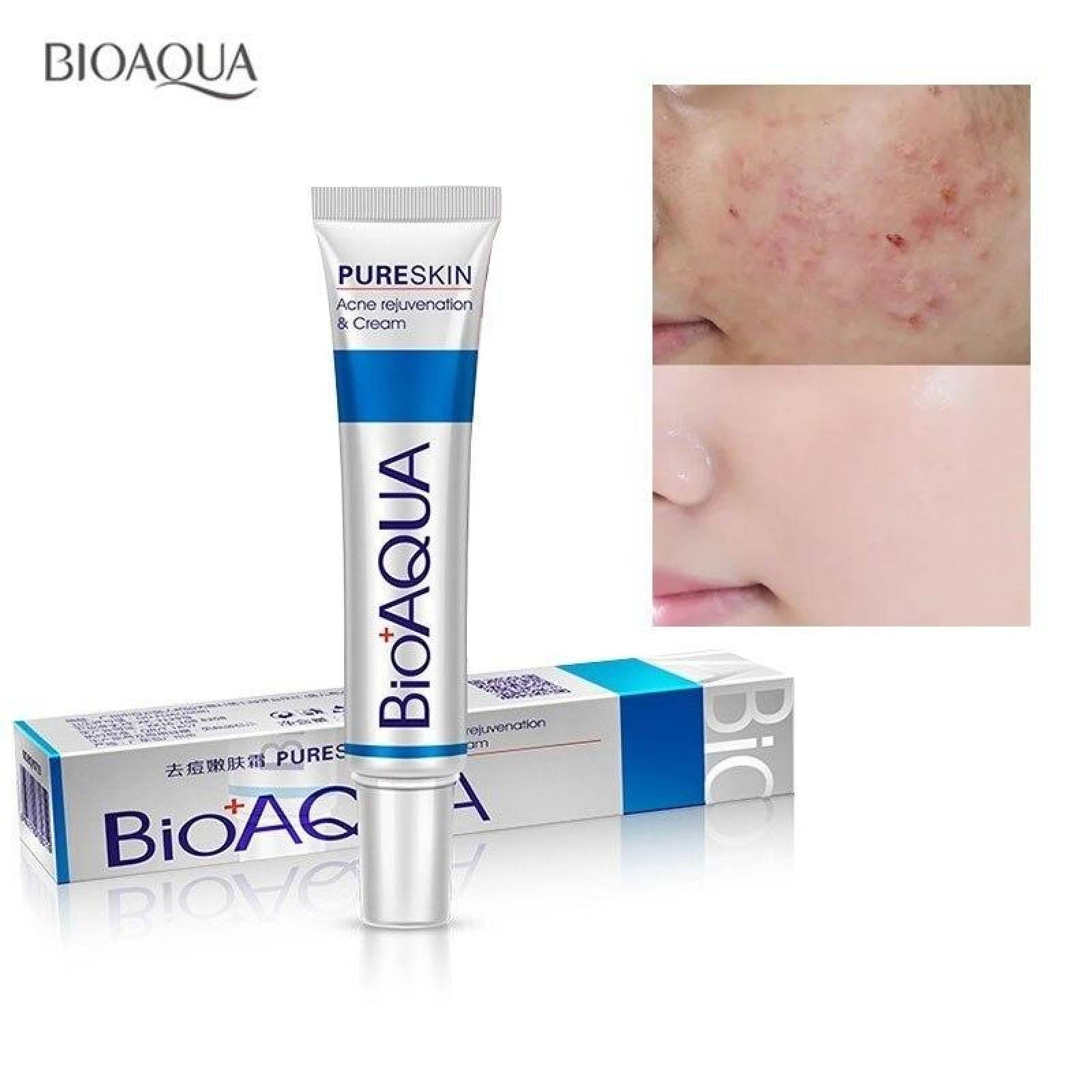 BIOAQUA Crema Anti Acne Pure Skin Cicatrices Control Grasa