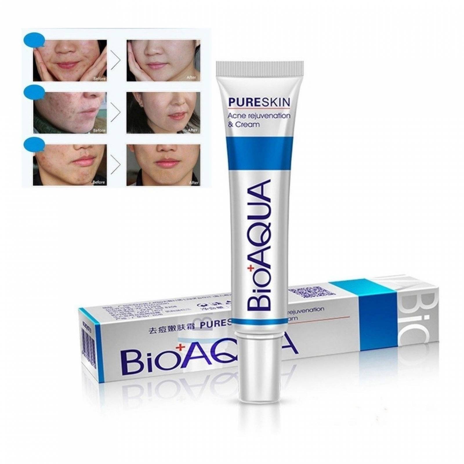 BIOAQUA Crema Anti Acne Pure Skin Cicatrices Control Grasa
