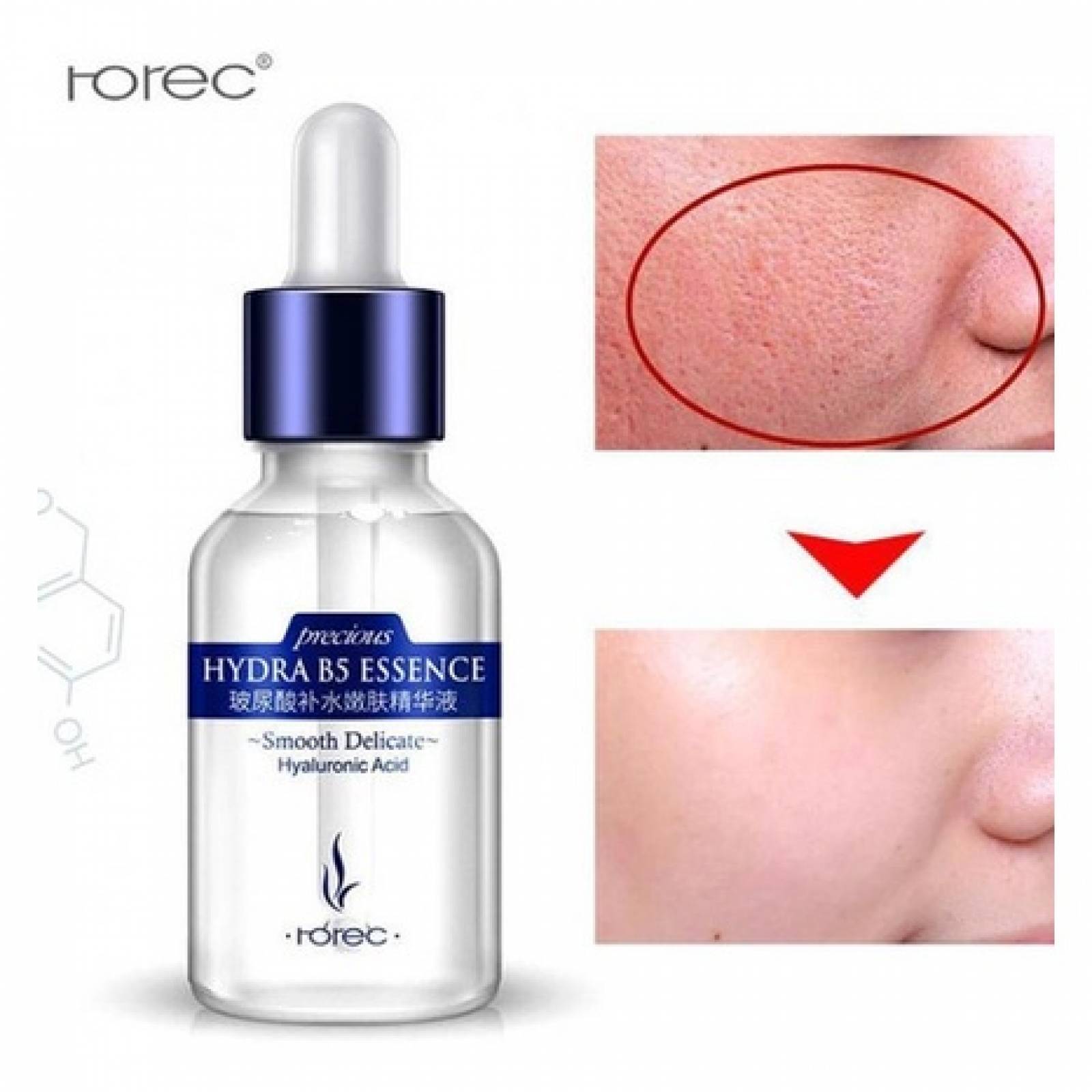 Ácido Hialurónico Hydra B5 Essence Anti Arrugas Hidratante.