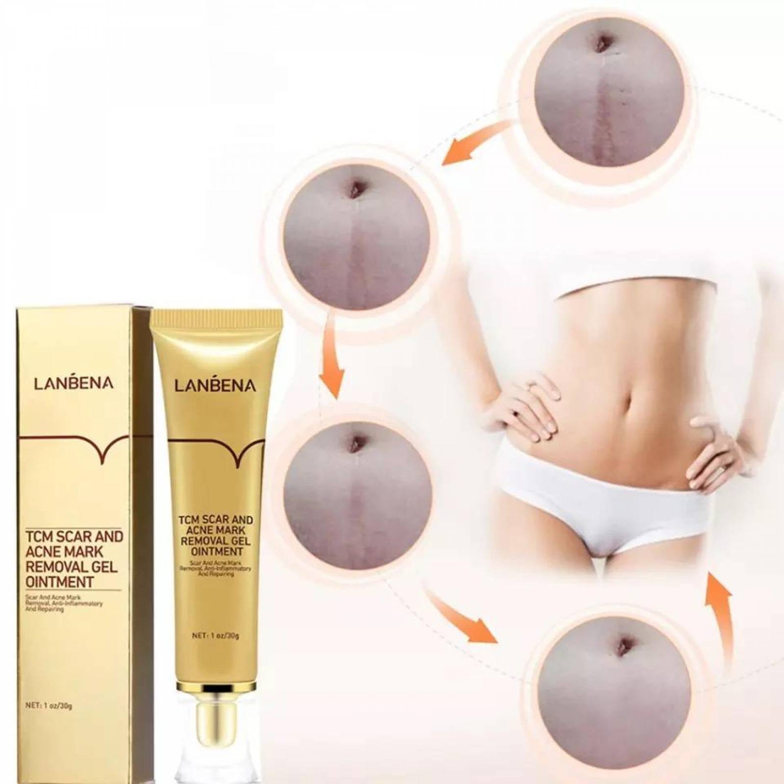 Gel Lanbena Cicatriz Acne Manchas Estrias Aclarante.