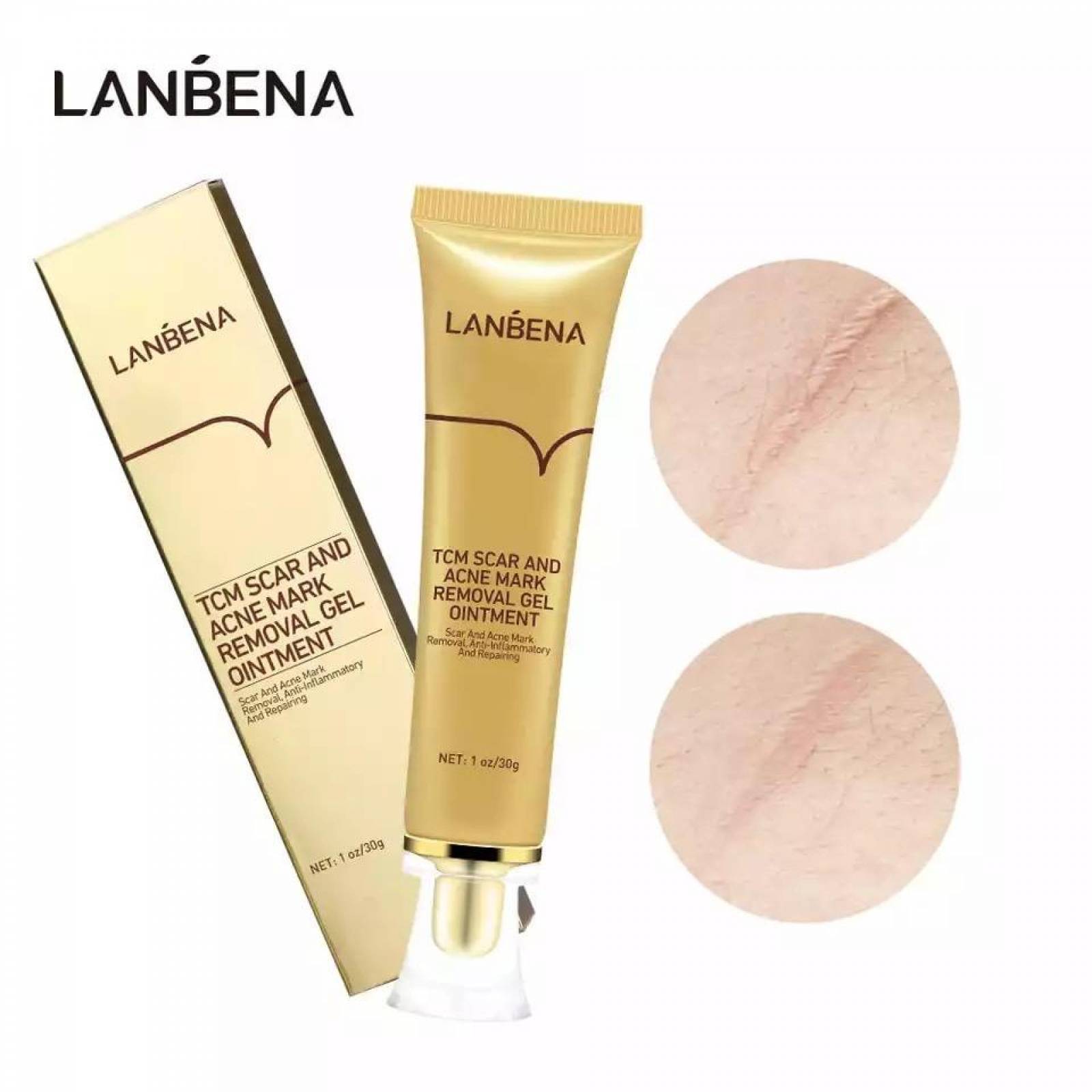 Gel Lanbena Cicatriz Acne Manchas Estrias Aclarante.
