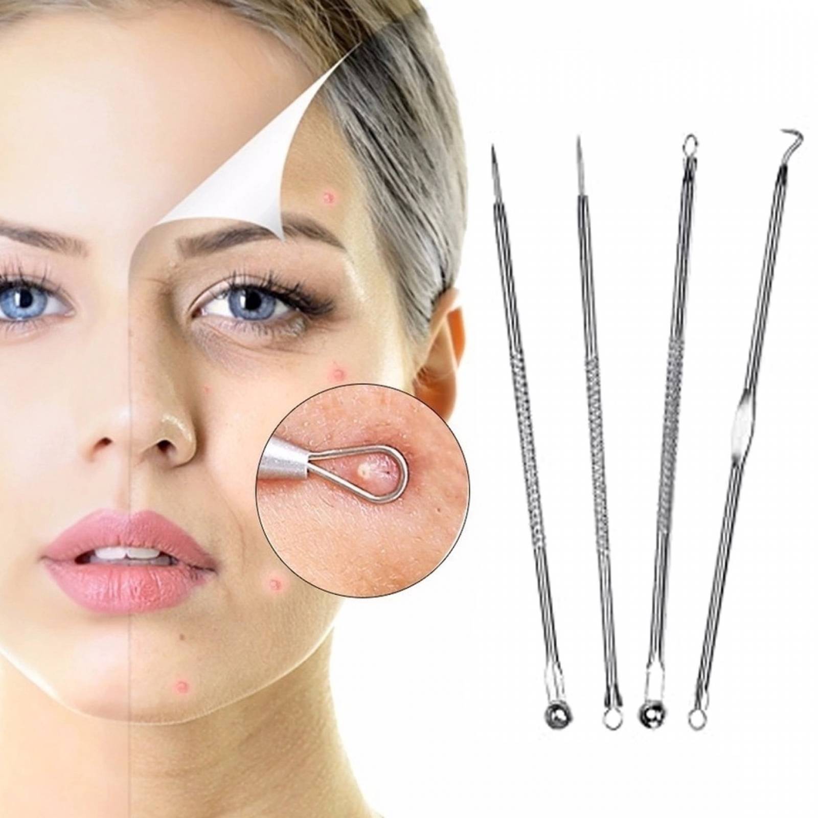 Kit Removedor De Espinillas Anti Acne Puntos Negros 4 Piezas.