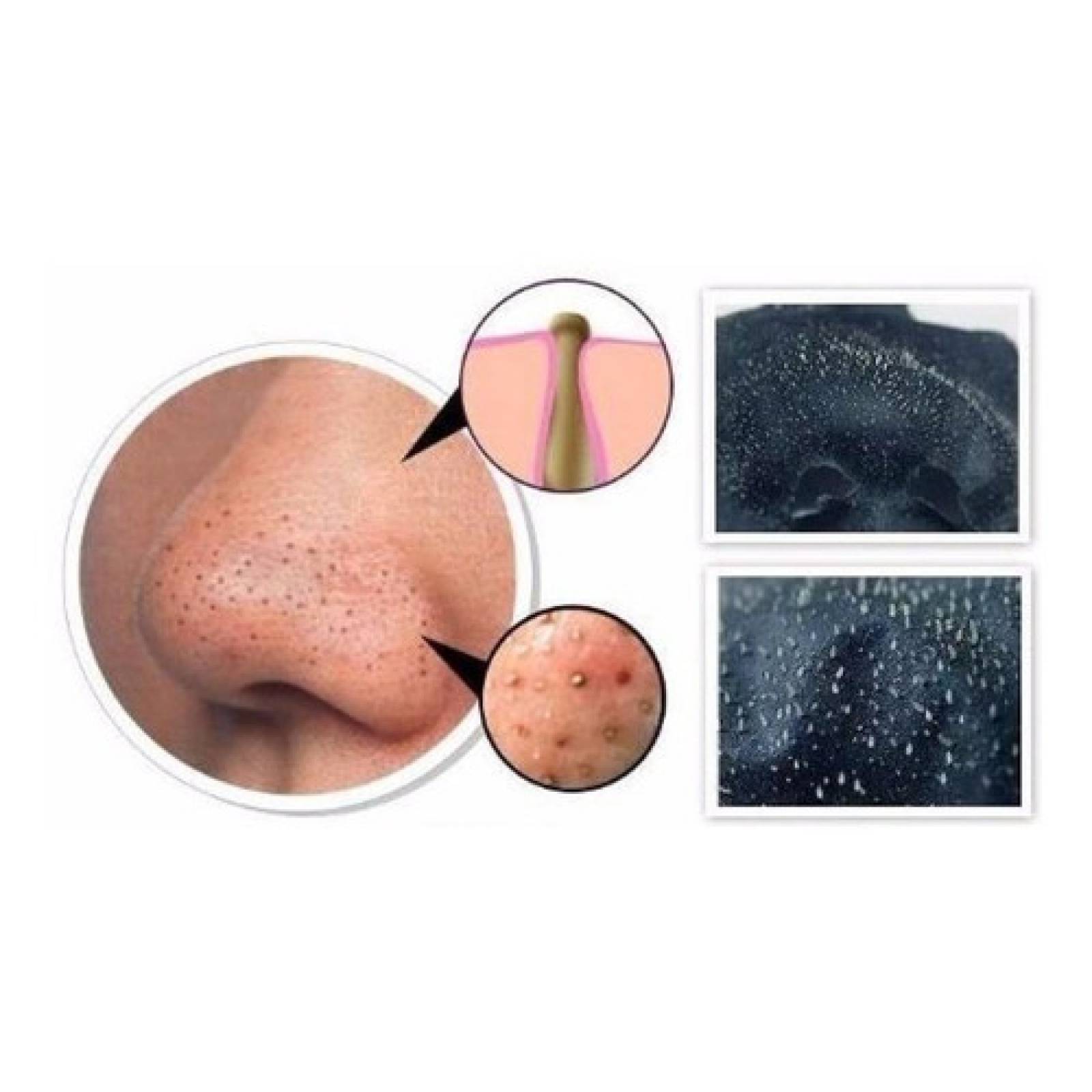 Pilaten  Para Puntos Negros 60 Grs.precio De Distribuidor