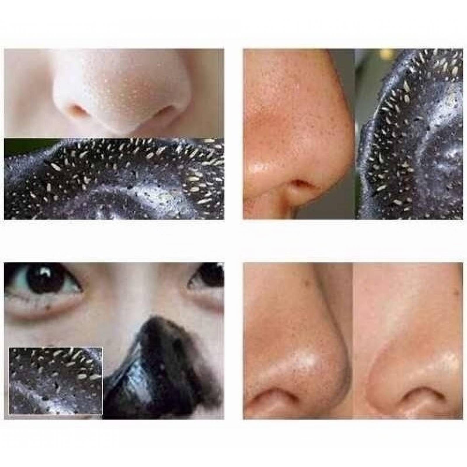 Pilaten  Para Puntos Negros 60 Grs.precio De Distribuidor