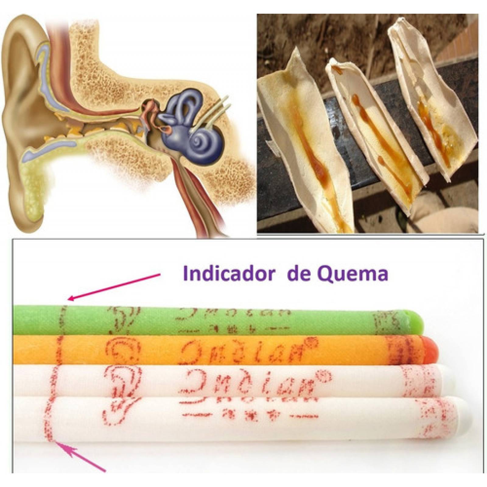 Conos De Cera Para Oídos velas de oídos