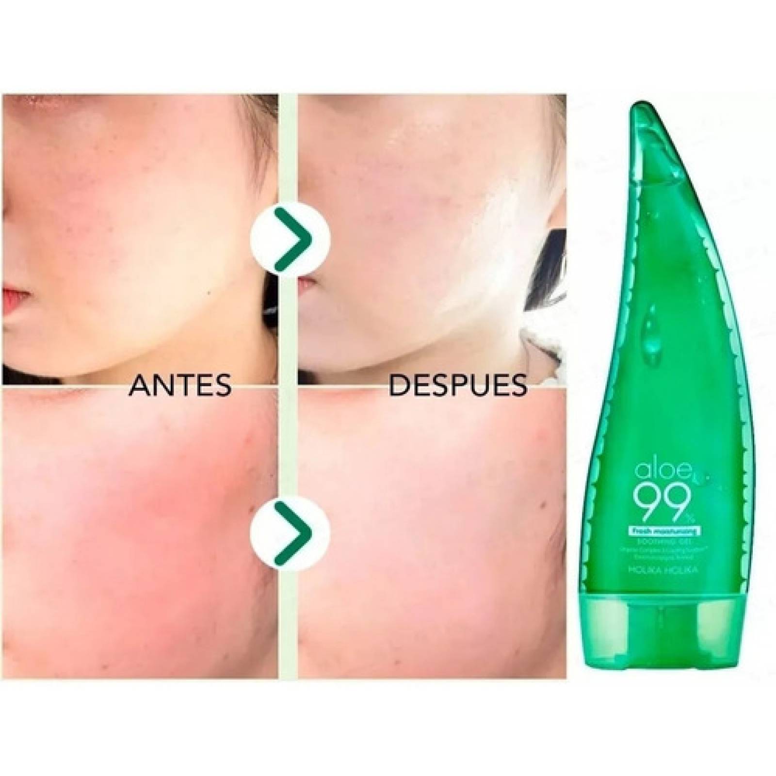Aloe Vera 99% Gel Sabila Facial Blanqueamiento Cicatriz