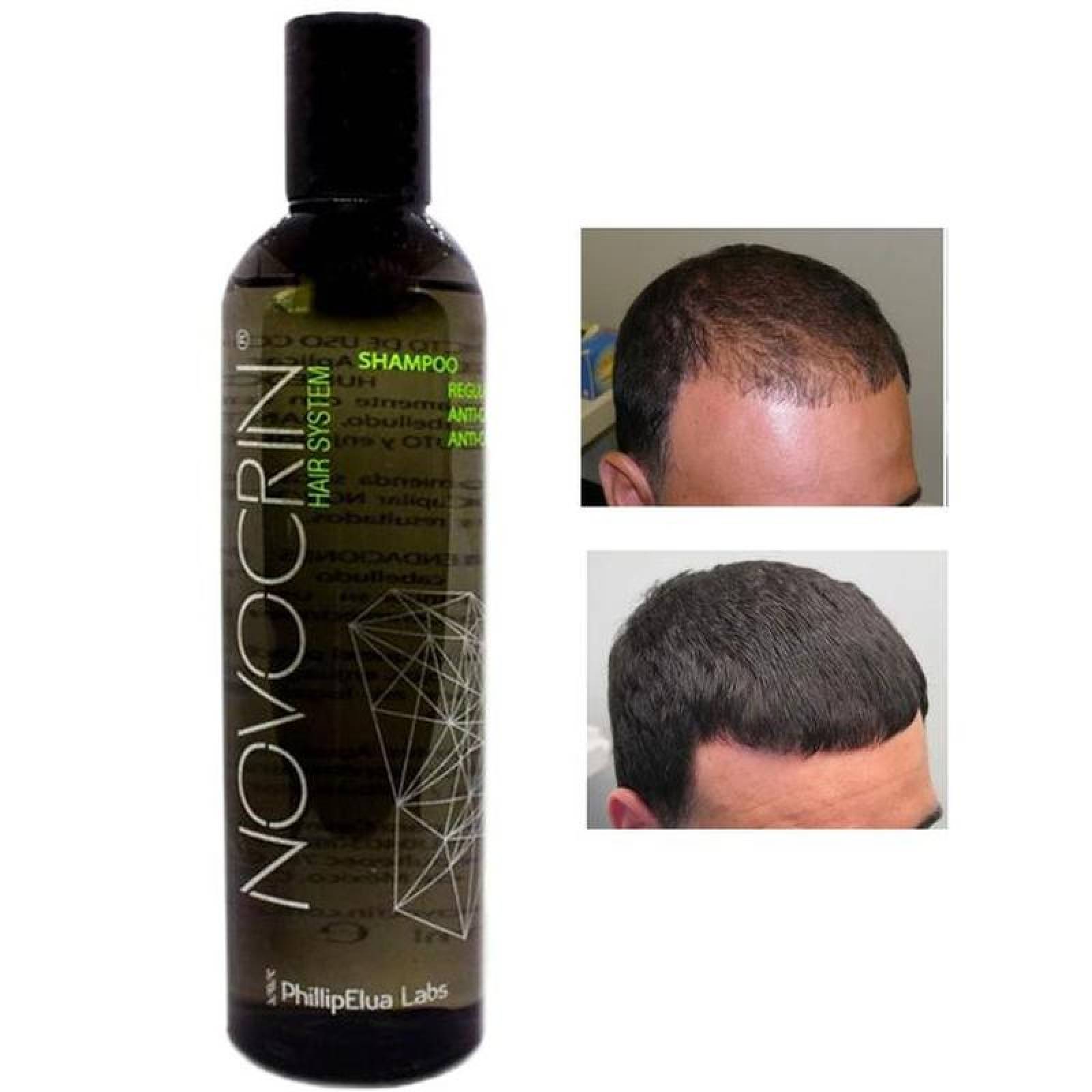 Shampoo del Crecimiento Capilar MXSHW-002-2 2 Pza 250ml Shampoo Unisex 100porciento Natural Botella Plástico Uso Diario, ShampGrow