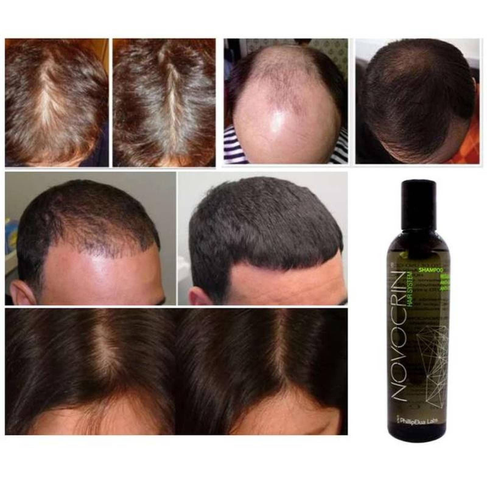 Shampoo Unisex para que crezca pelo MXSHW-004-6 5 Pza 250ml Shampoo Unisex 100porciento Natural Botella Plástico Uso Diario, ShampGrow