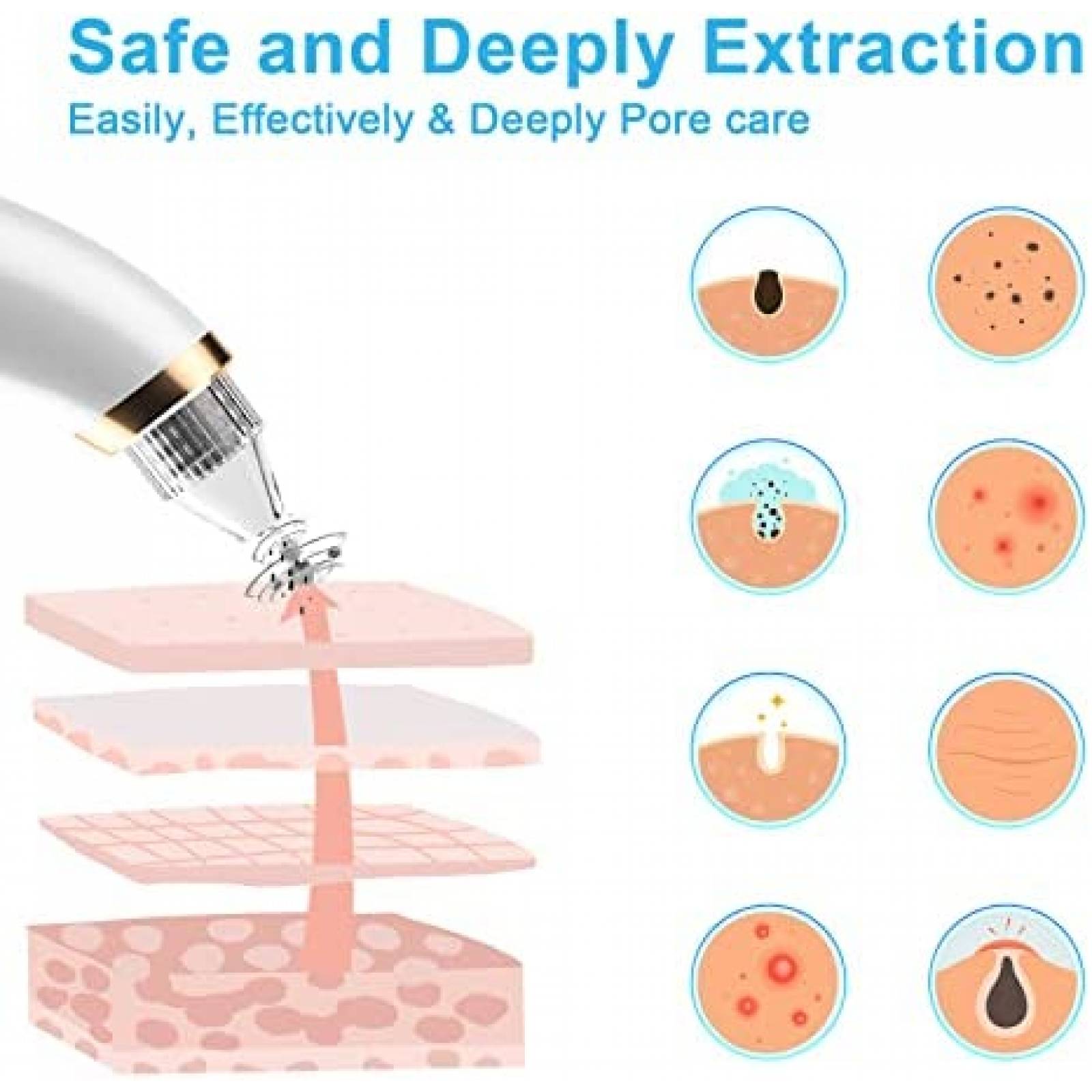 Removedor de Espinillas DANGZW 5 Direfentes Cabezales Blanco