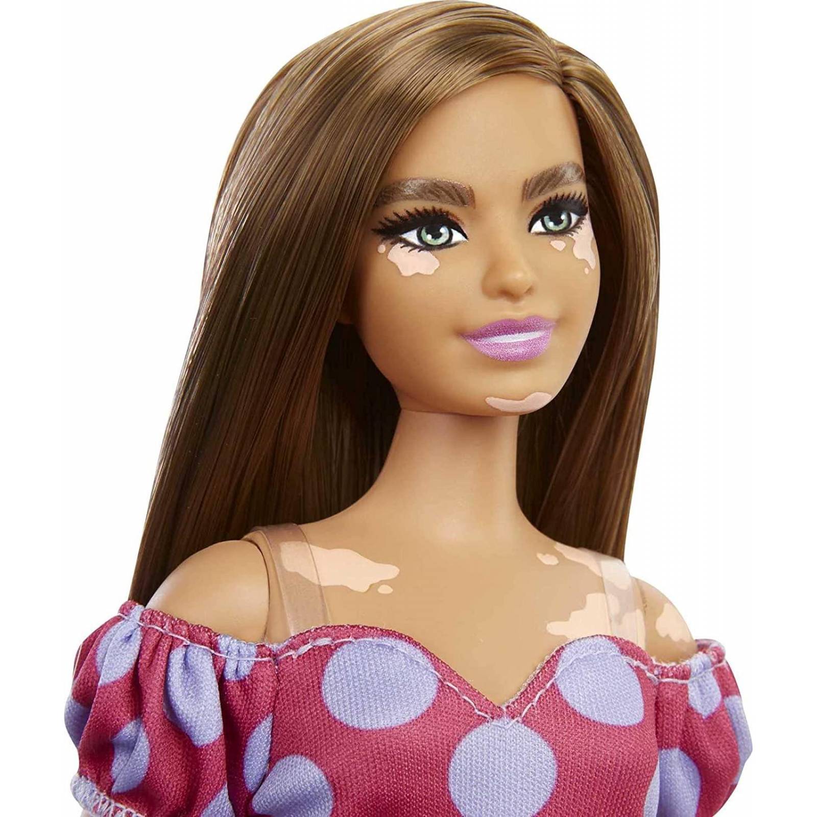 Barbie best sale con vitiligo