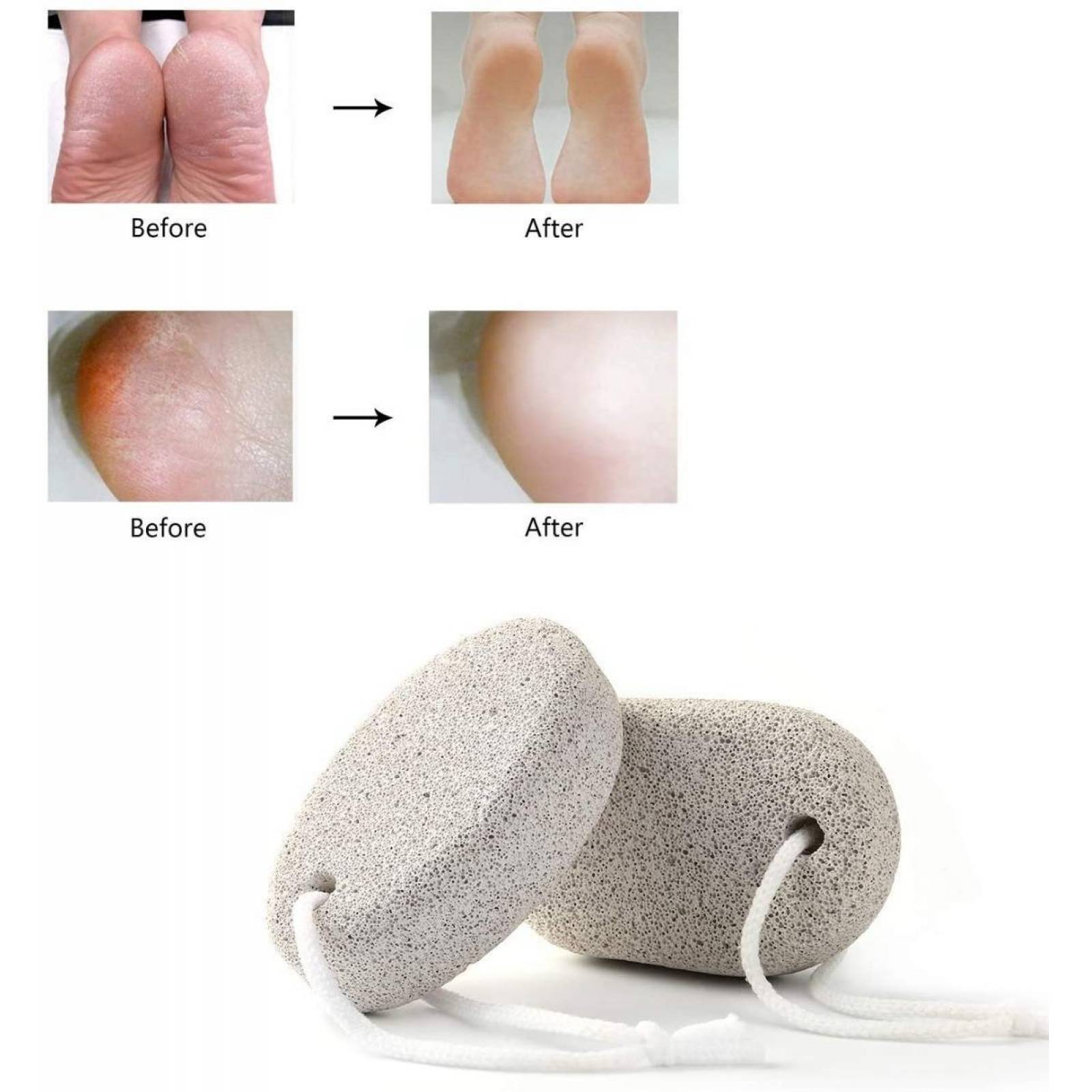 Triko Piedra Pomez Naturales Para Belleza Y Cuidado Personal 