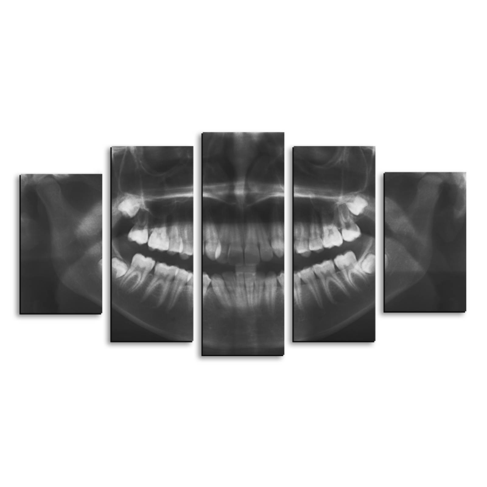 Cuadro decorativo Radiográfia de Dientes Decoración para Dentistas Consultorio 150x80cm 5 piezas