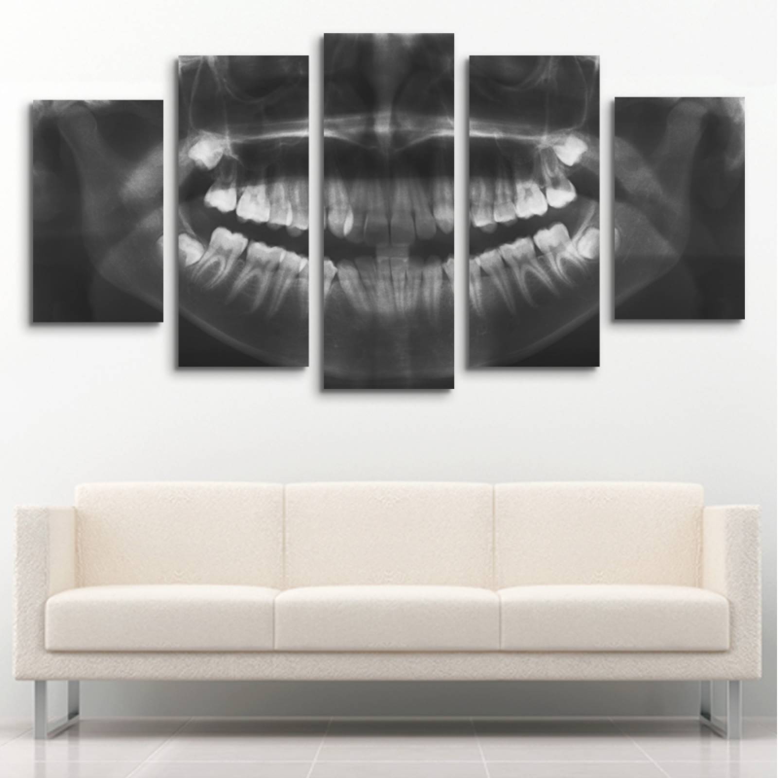 Cuadro decorativo Radiográfia de Dientes Decoración para Dentistas Consultorio 150x80cm 5 piezas