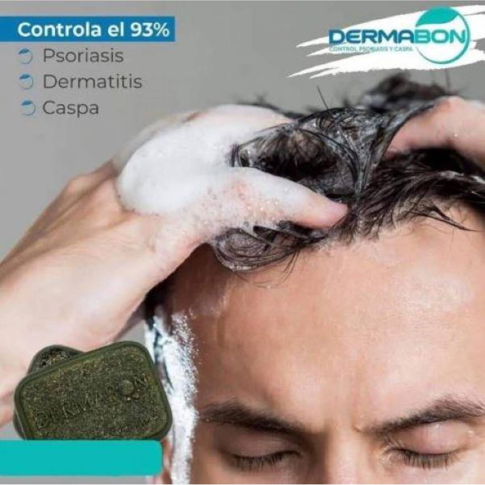 Jabón Para Psoriasis y Dermatitis, Dermabon 3 pzas 