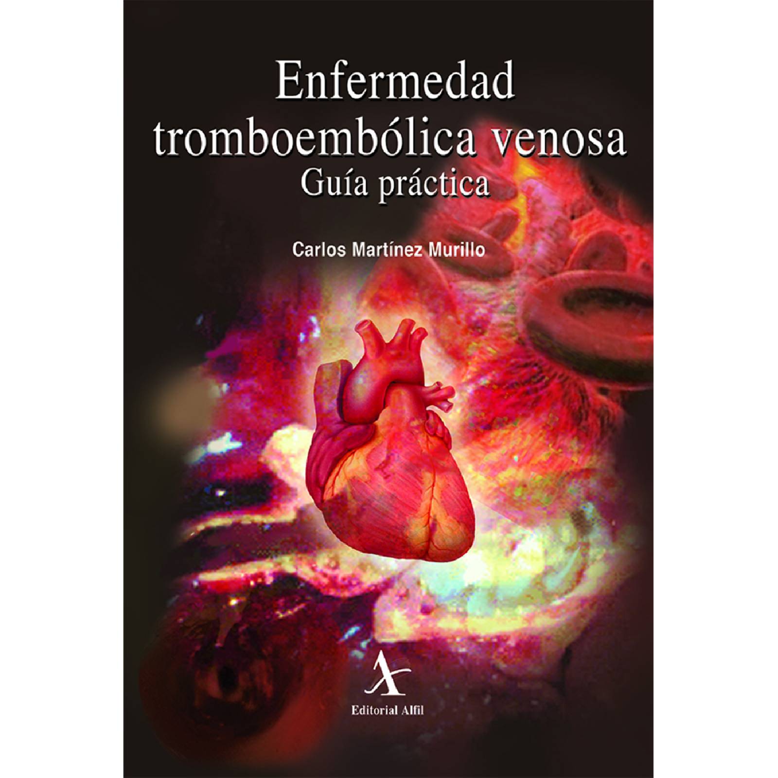 Enfermedad Tromboembólica Venosa