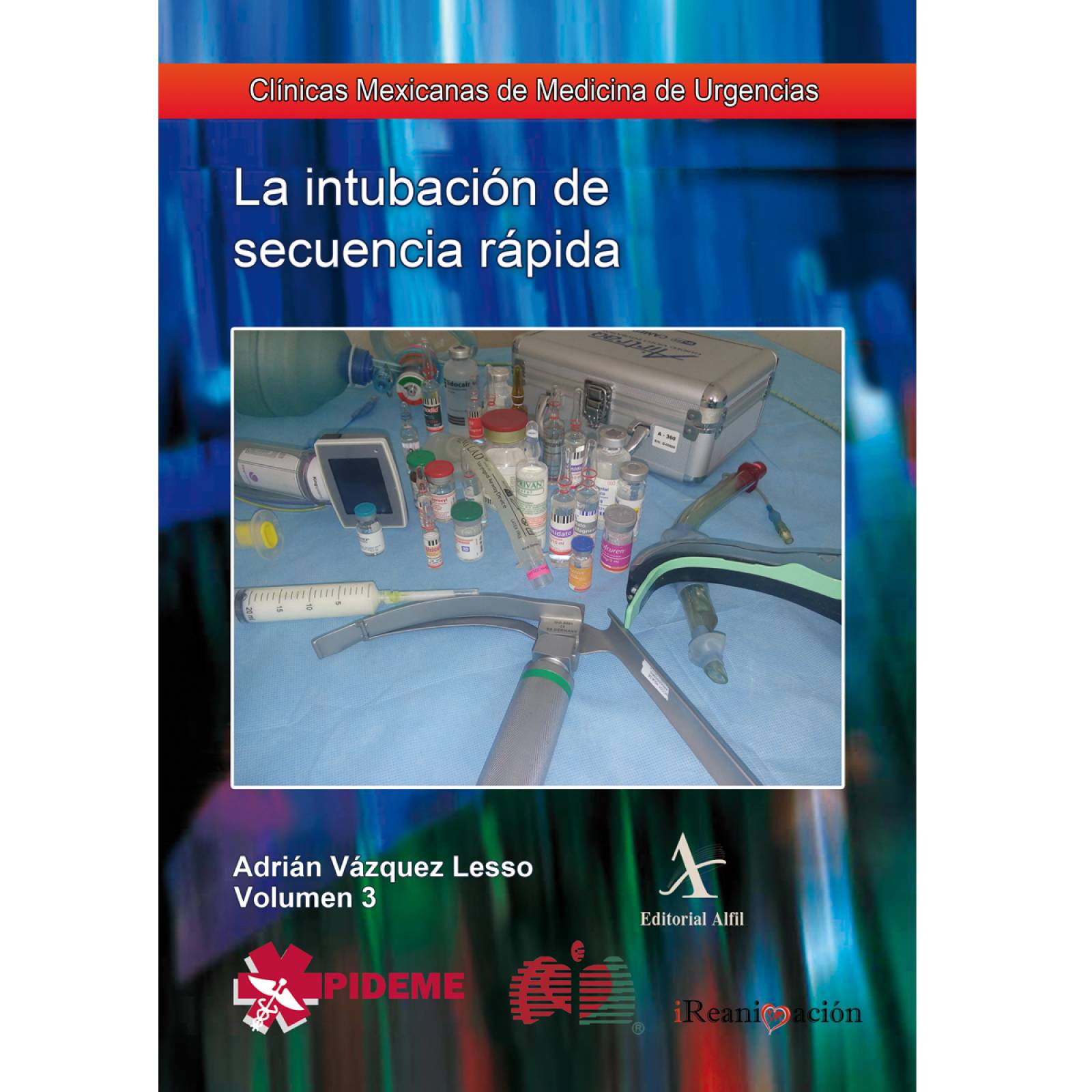 La intubación de secuencia rápida