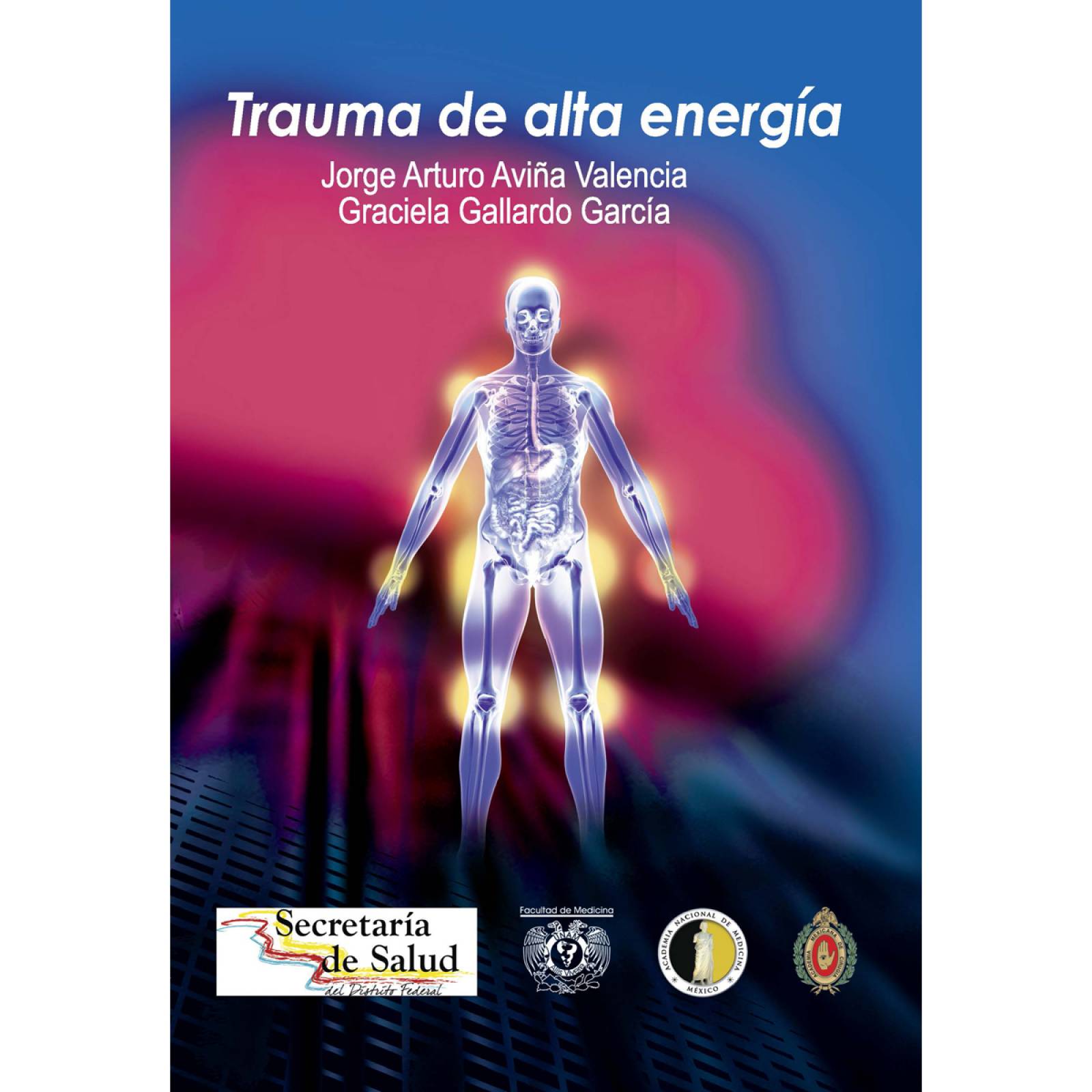 Trauma de alta energía