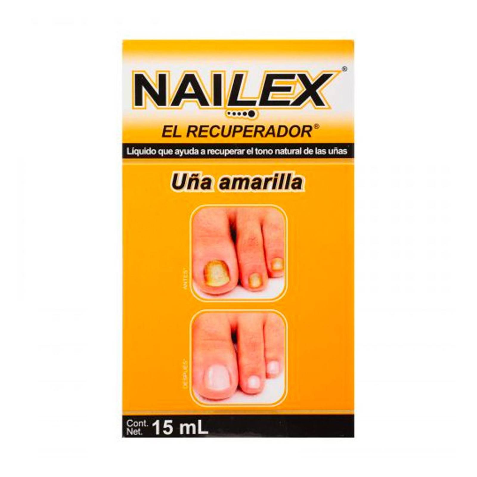 Recuperador Nailex Uñas Amarillas 15 ml 