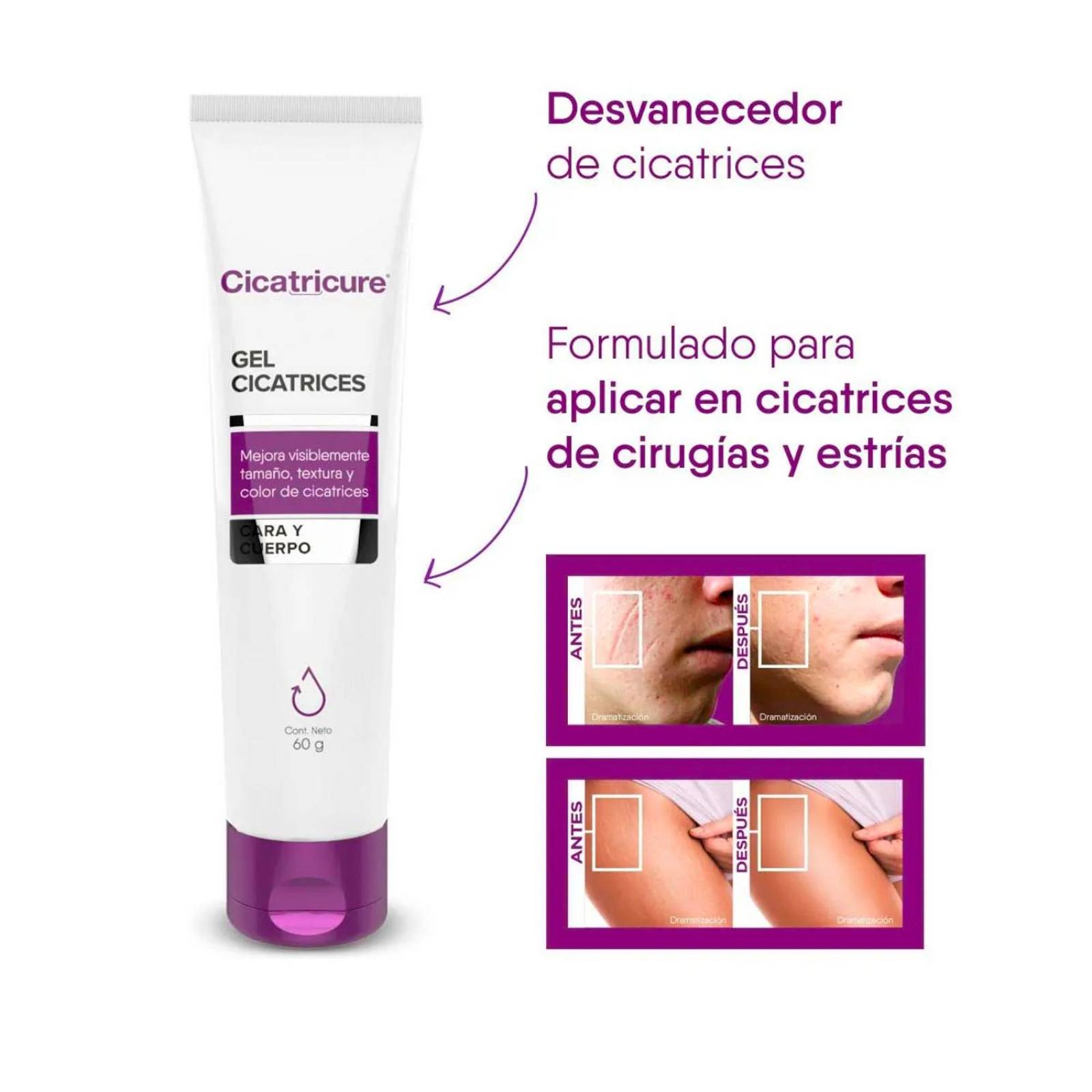 Gel Cicatricure Cicatrices y Estrías 60 gr 
