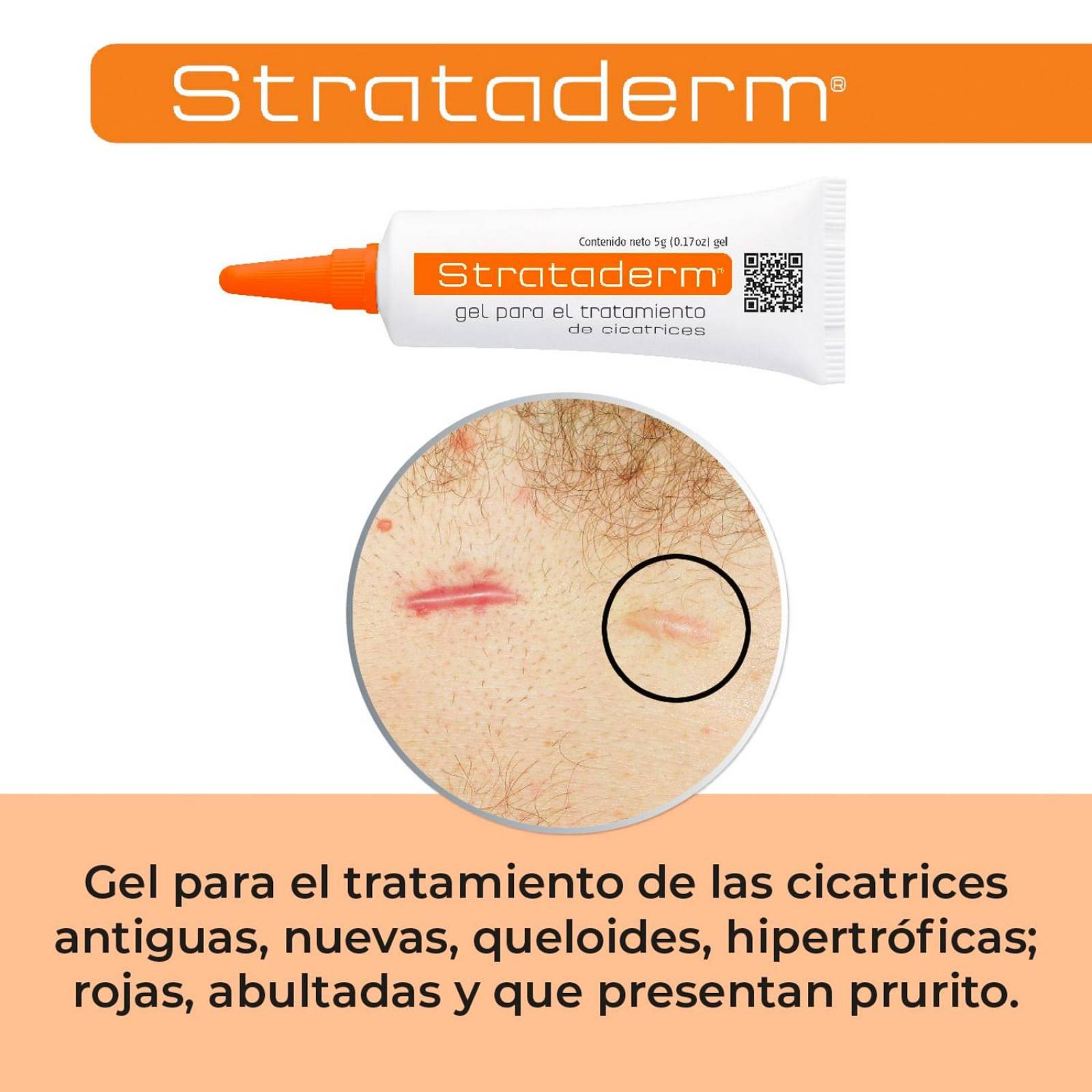 Gel de Silicona Strataderm para Cicatrices 5 gr 