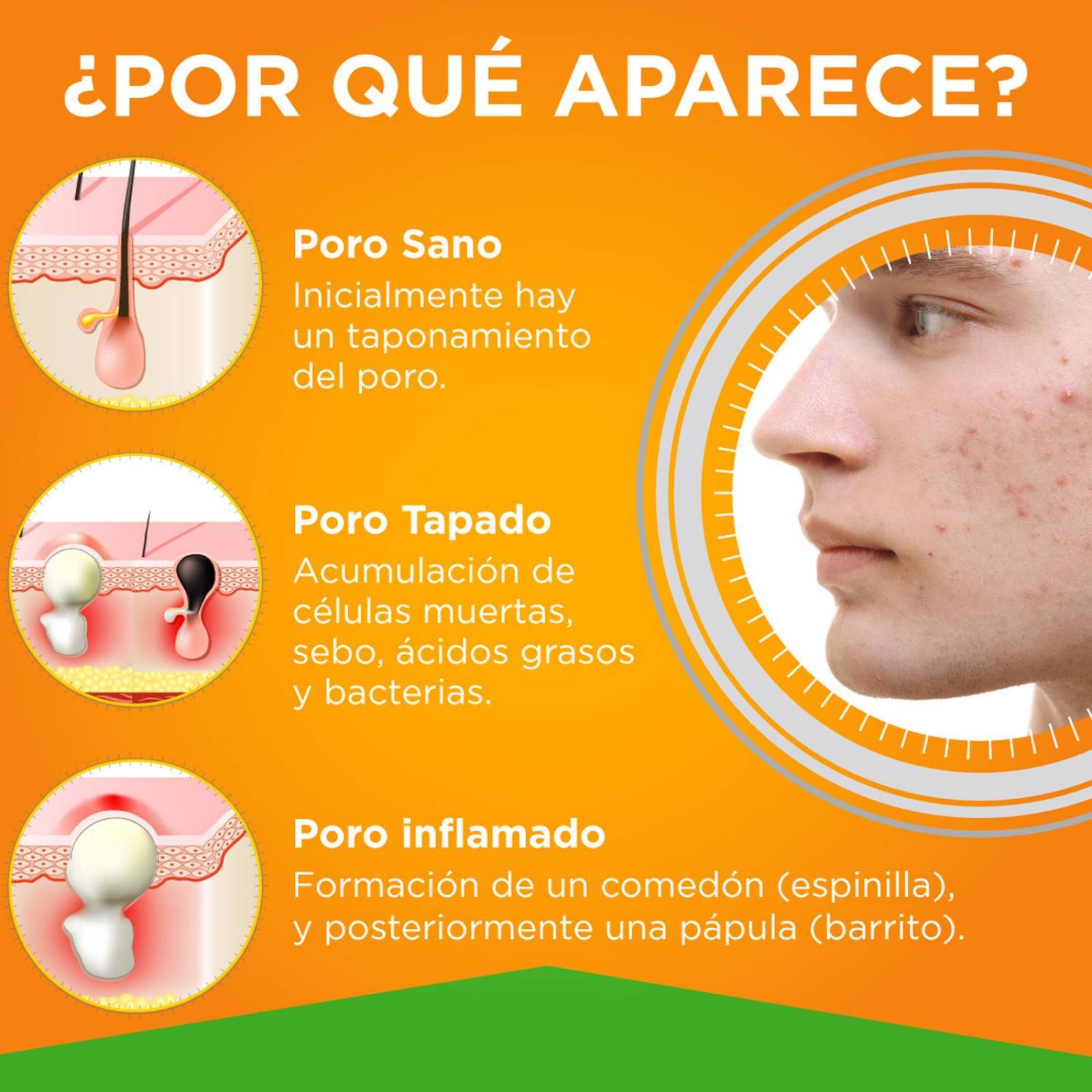 Trioximed | Rutina Anti Acné Trío Trioxi Tree