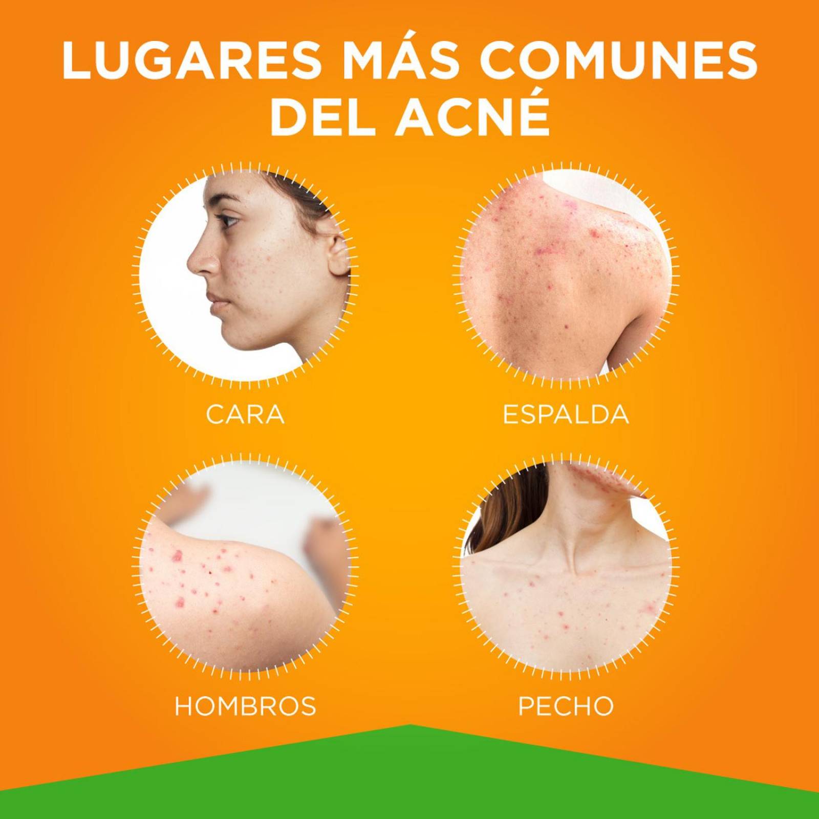 Trioximed | Rutina Anti Acné Trío Trioxi Tree