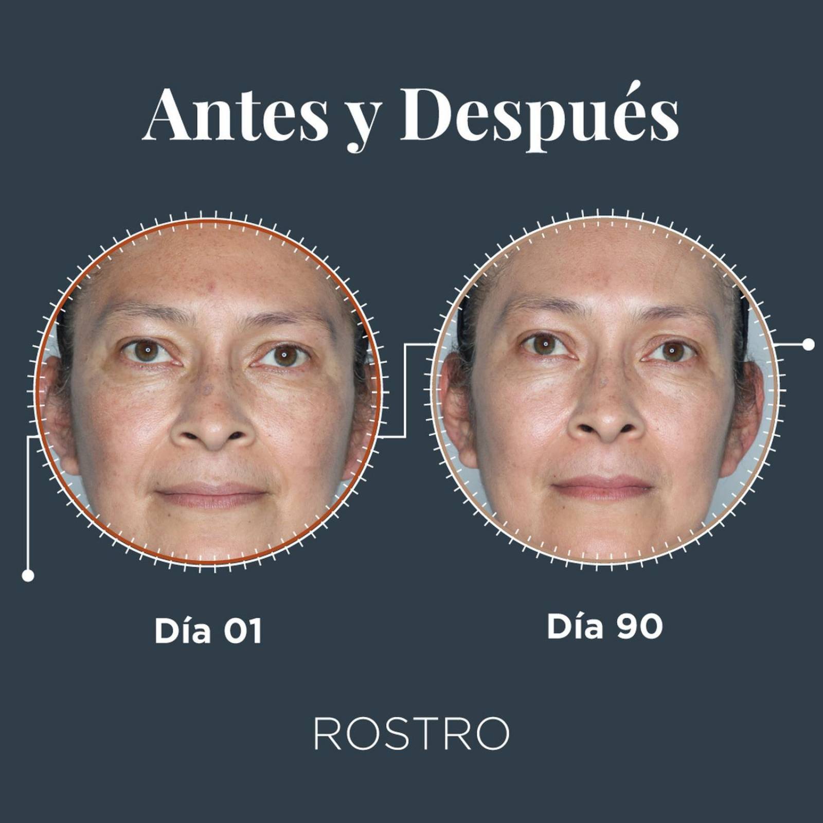 Trioximed - Crema Aclaradora 30 Gr Edición Polvo De Perla 