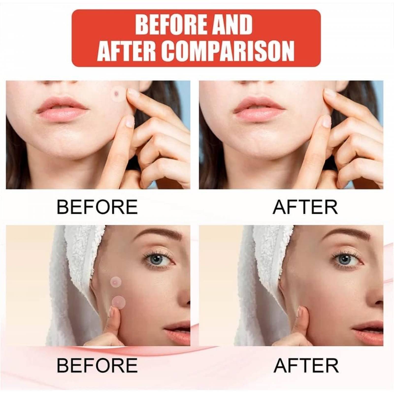 Parche Invisible para el cuidado de la piel granos y acné
