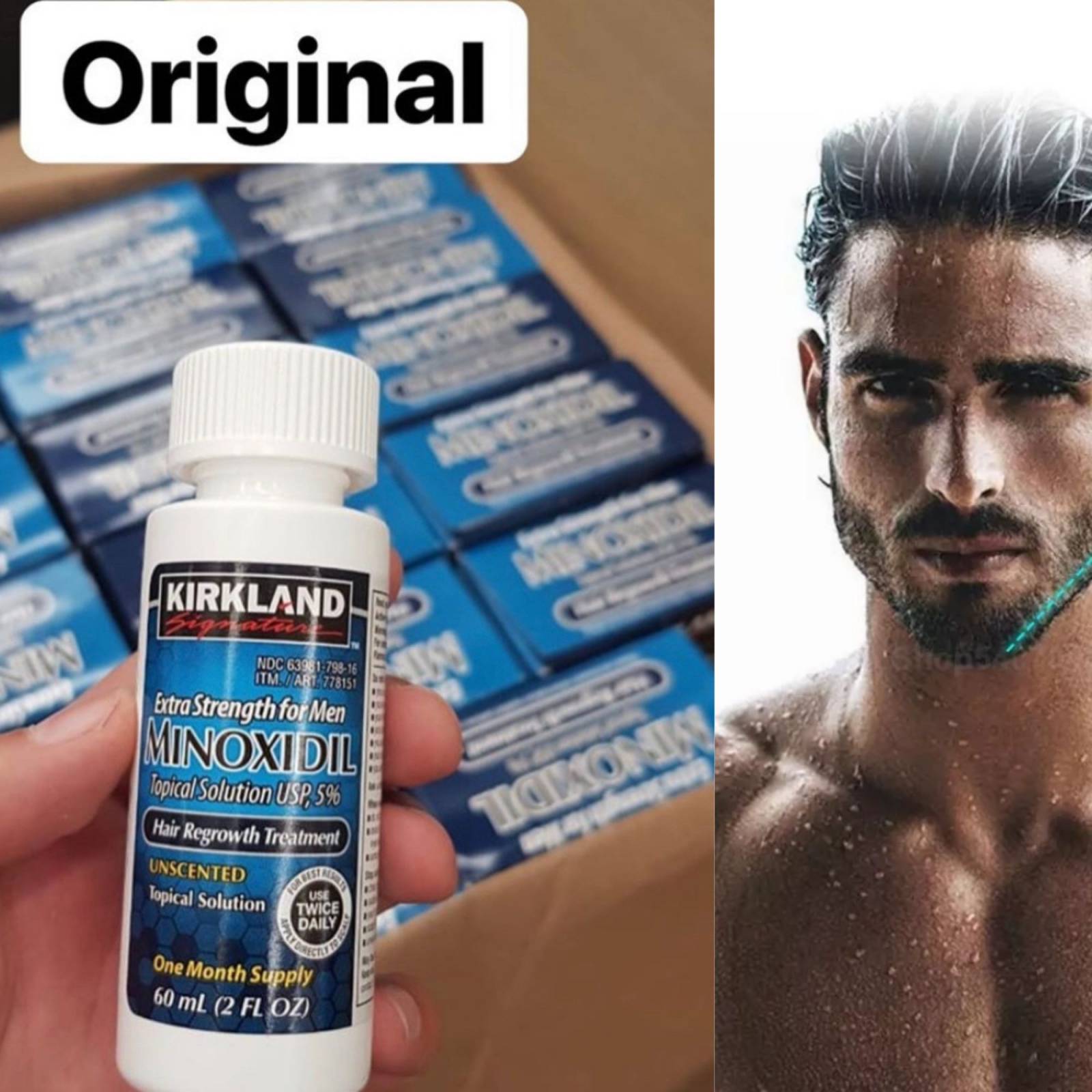 Minoxidil 5% 6 Cajas Para Crecimiento Capilar Barba Y Bigote, Disminuye la pérdida de cabello, Kirkland Signature.