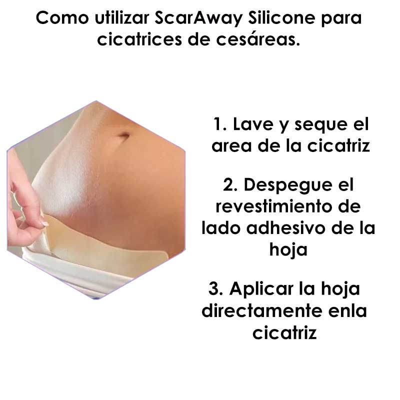 Parches Silicon Para Cicatrices Scaraway 3.8 x 7.6 cm con 8 parches elimina cicatrices