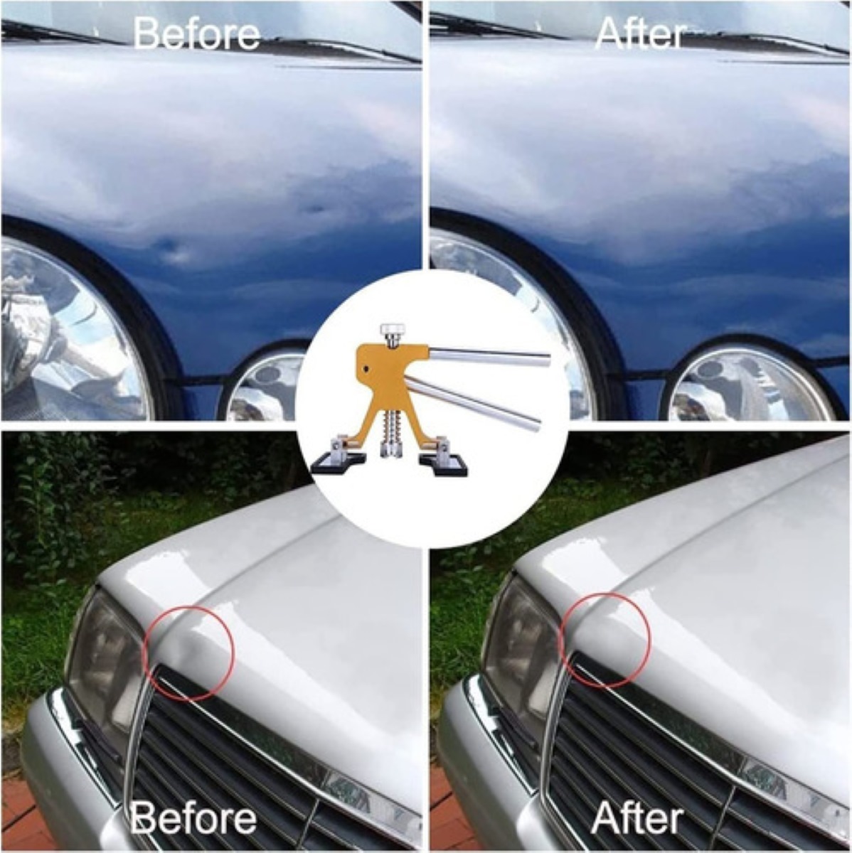 Kit Ventosa Saca Golpes De Auto 49 Pcs Ventosas Abolladuras