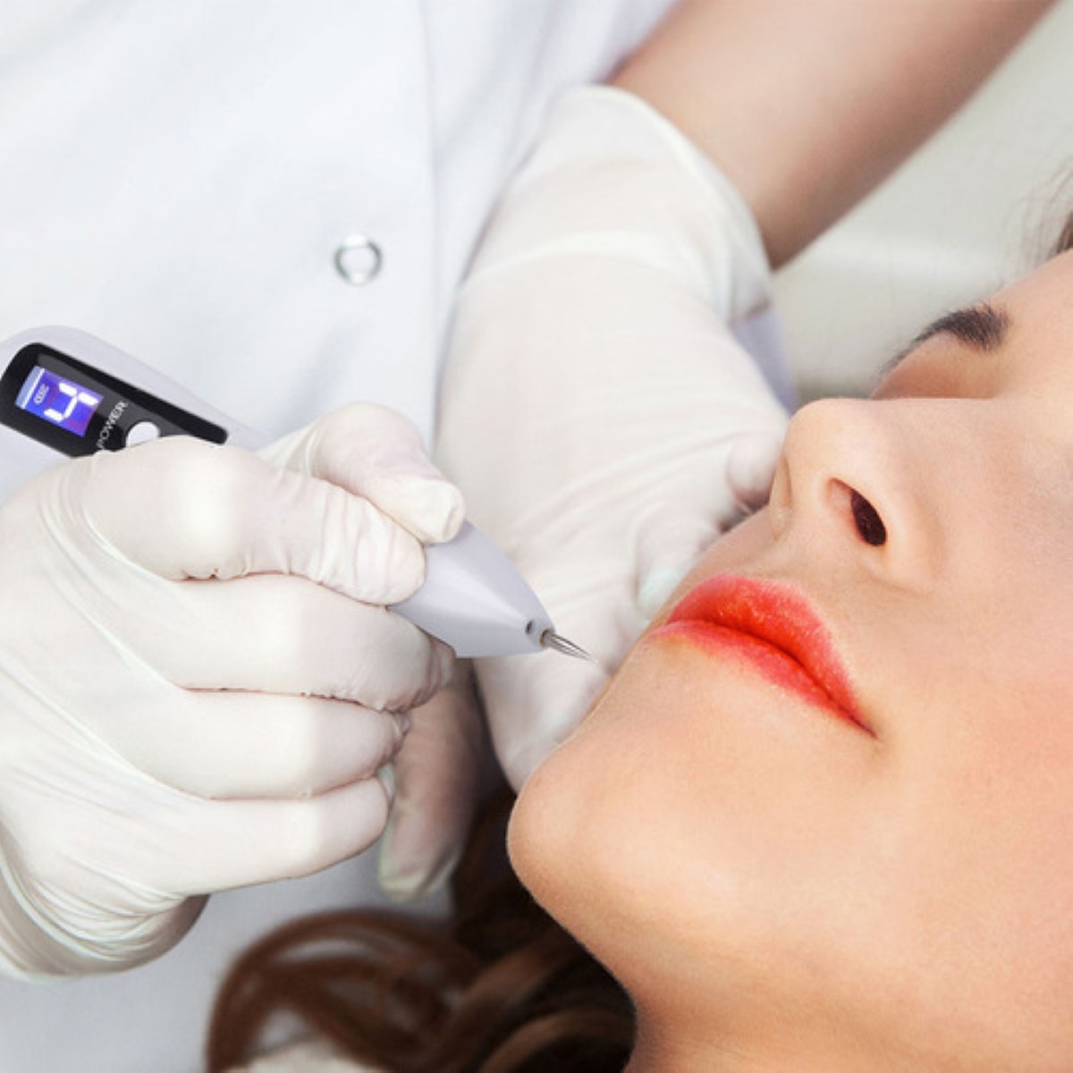 "Herramienta Para Quitar Verrugas Cauterizadora Rosado ".