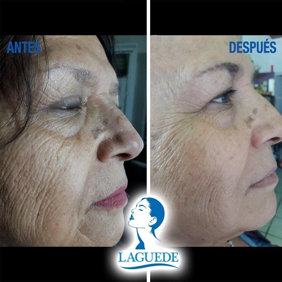 Kit Facial Aclarante Anti-edad Crema Día + Gel Noche + Jabón Leche de Burra Piel Seca/Normal 