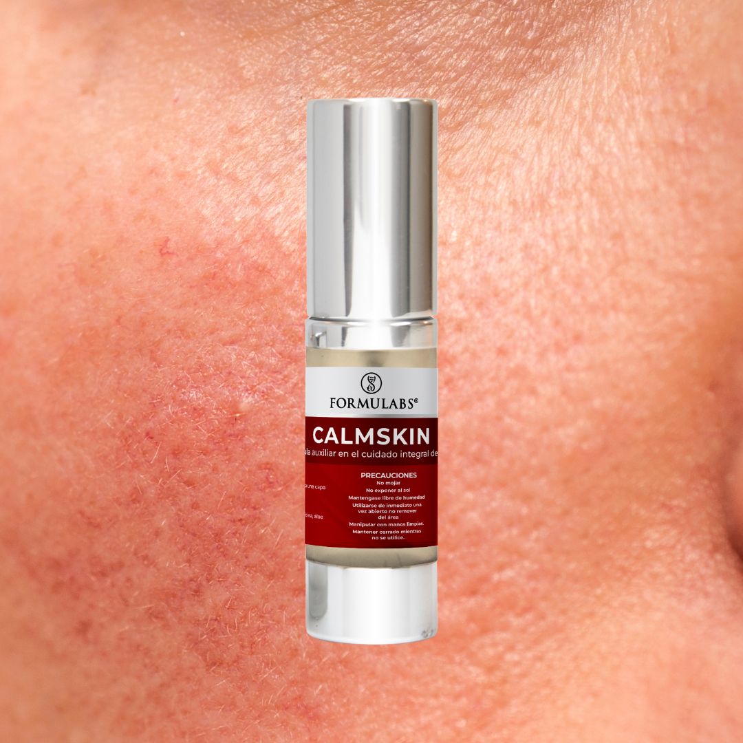 Crema Facial y Corporal, Previene Y Cura Quemaduras De Sol, ayuda a pieles con Psoriasis, dermatitis atópica (eccema), Urticaria, Melasma y Acné activo. 25g - Calmskin- Formulabs