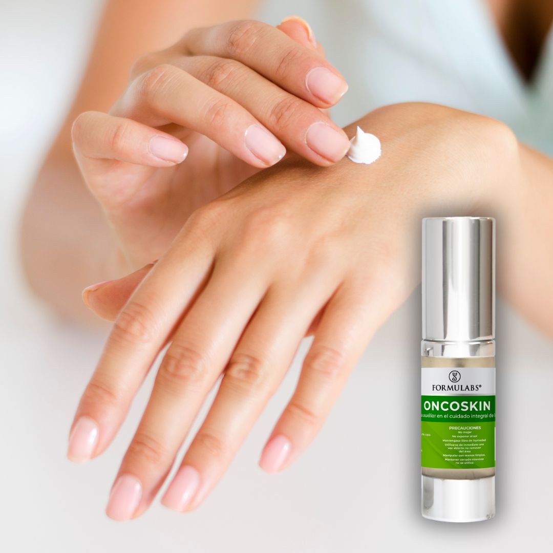 Crema Facial y Corporal para Piel Oncológica y Pacientes Diabéticos, Calma y Previene las Molestias, 25gr, Oncoskin - Formulabs