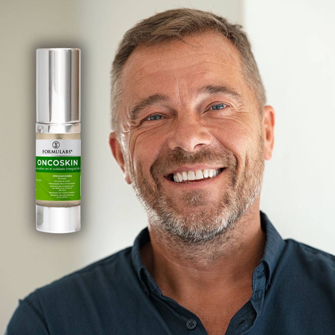 Crema Facial y Corporal para Piel Oncológica y Pacientes Diabéticos, Calma y Previene las Molestias, 25gr, Oncoskin - Formulabs