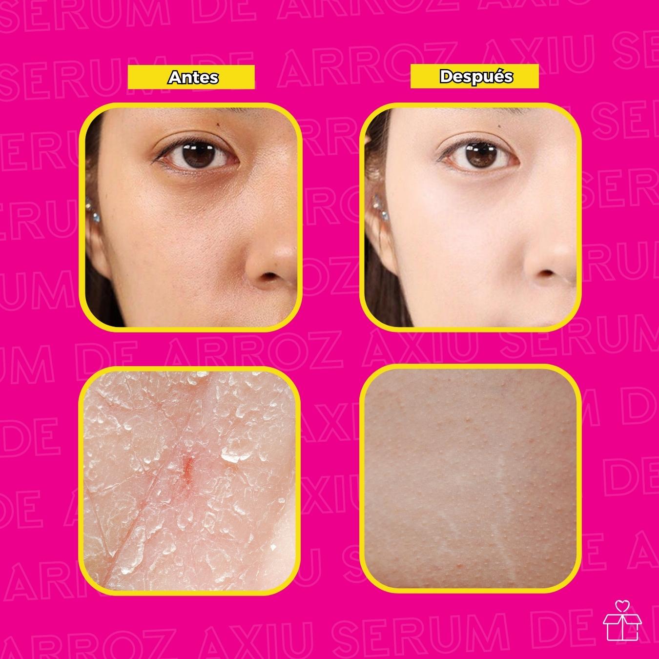 Serum De Arroz Blanco Aclarante White Rice.