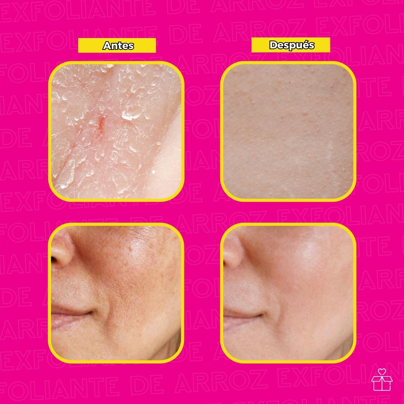 Exfoliante de Arroz Hidratante Aclarante.