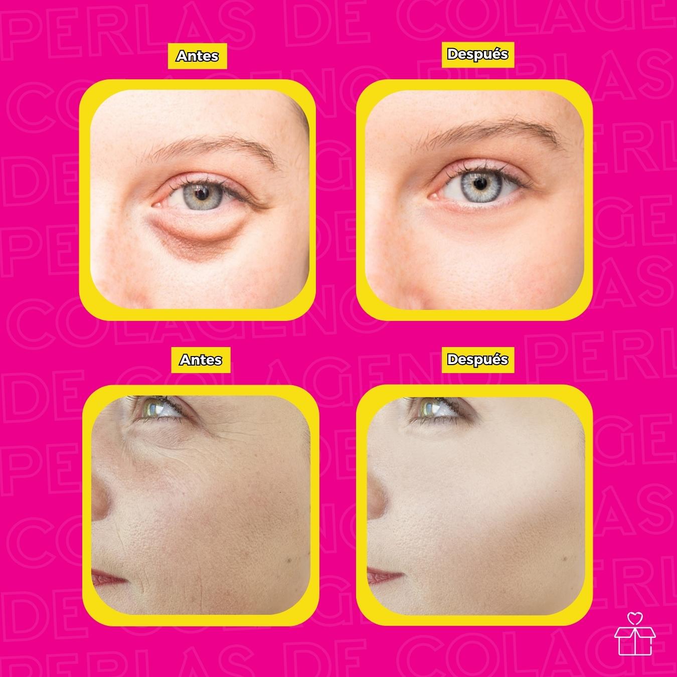 Cápsulas Faciales Vitamina E Elimina Arrugas.