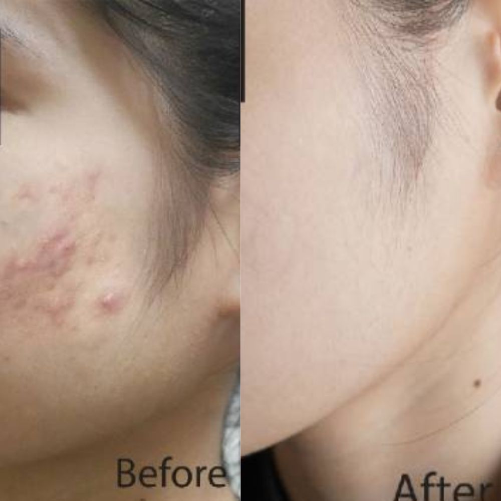 Serum Reafirmante. Efecto Lifting. Reduce Arrugas y Líneas de Expresión.