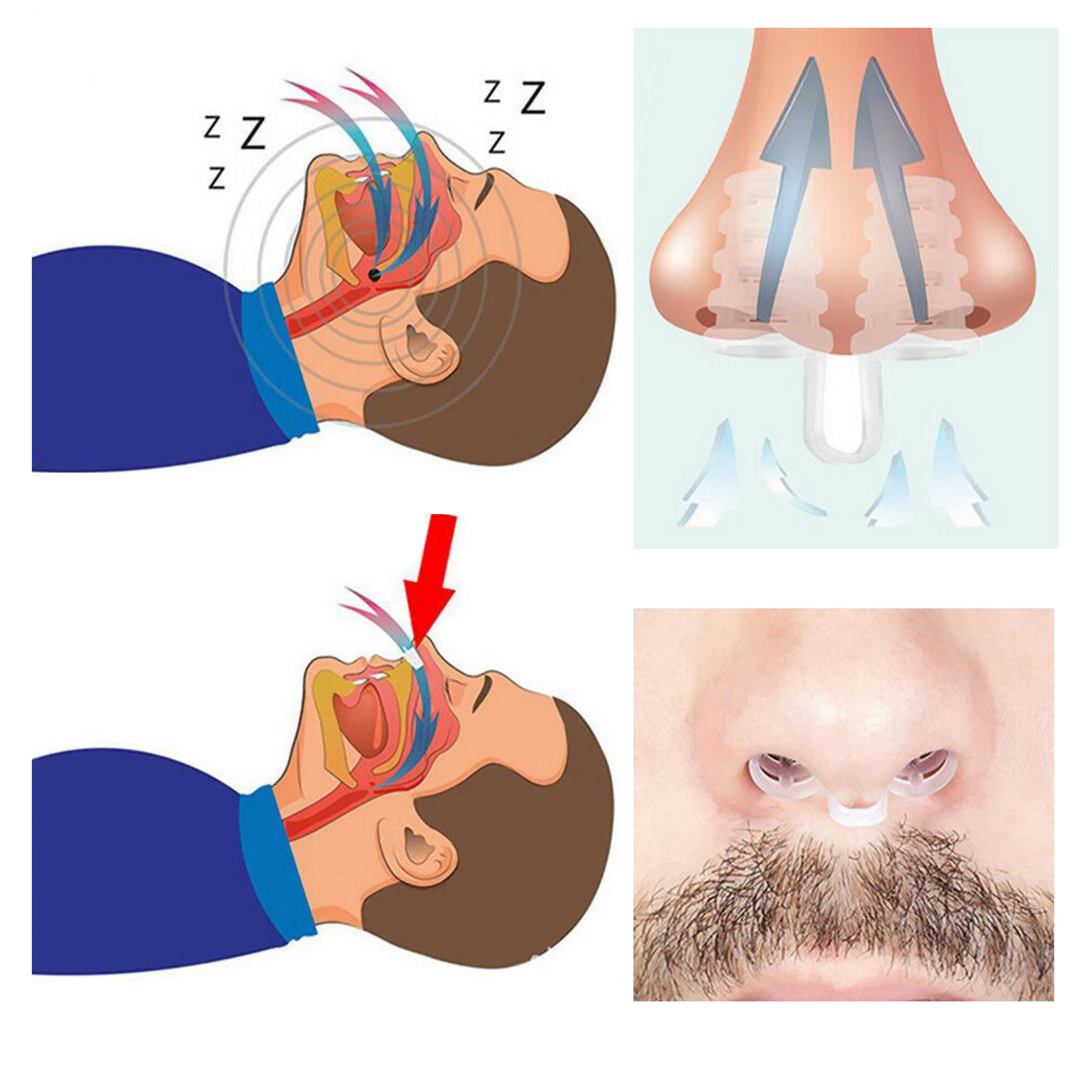 4 Dispositivos Anti Ronquidos Dilatador Nasal  Respira Mejor