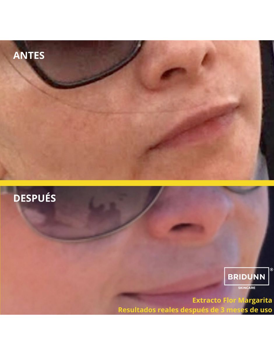 Kit Piel Revitalizada Quitamanchas + Antioxidante, Suero Facial Despigmentante Quita Manchas Aclarante Y Crema Facial Antioxidante Antiedad con Vitaminas E, A, D . Kit Tratamiento Piel Radiante Bridunn 2 productos