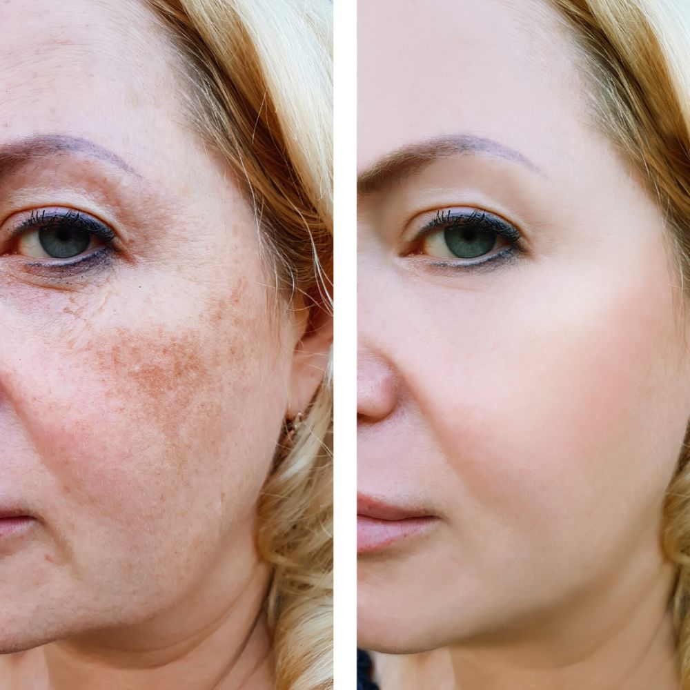 Rutina Adiós Líneas de Expresión y Manchas Faciales. Elimina Manchas y Mejora el Aspecto Facial. Rutina Nocturna.