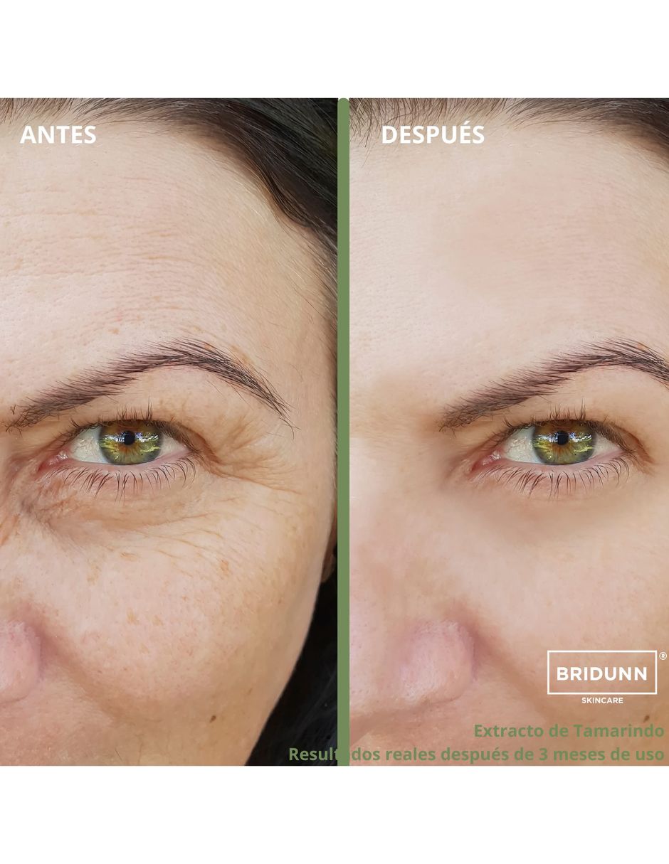 Pack Belleza Facial, Antimanchas + Antiarrugas, Suero Despigmentante Facial Aclarante Quita Manchas Piel Y Crema Facial Para Eliminar Arrugas Efecto Lifting. Kit Tratamiento Reparador 2 pza