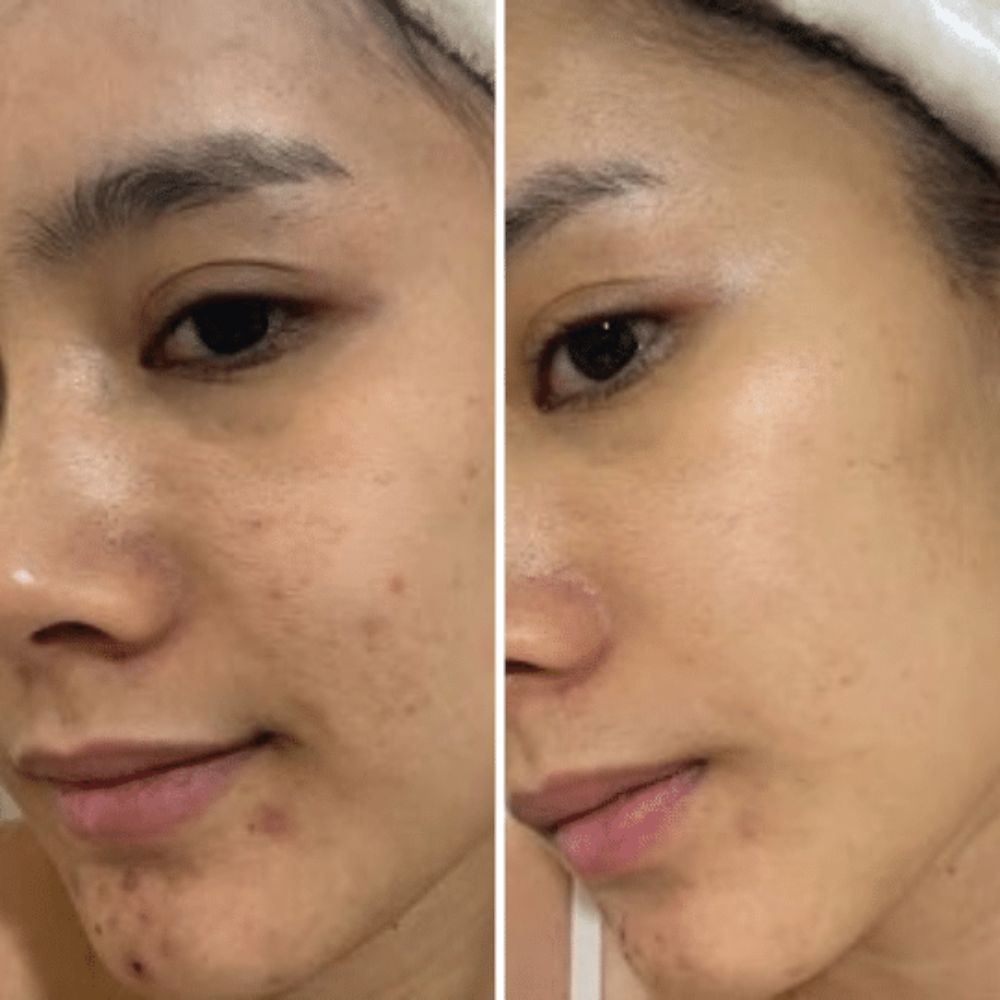 Kit Thanaka y Granada Night and Day. Elimina Manchas Solares y Hormonales. Rutina de Skincare Completa. Hidratación y Protección