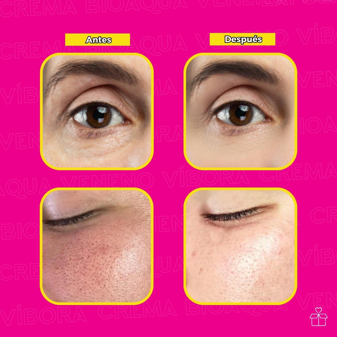 Crema de Veneno De Víbora Elimina Ojeras.