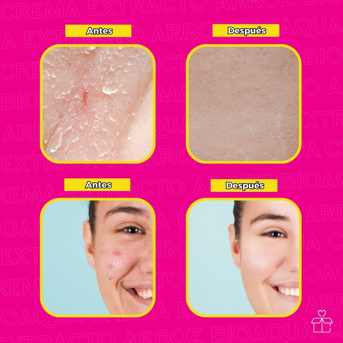 Crema Hidratante Con Extracto de Arroz .