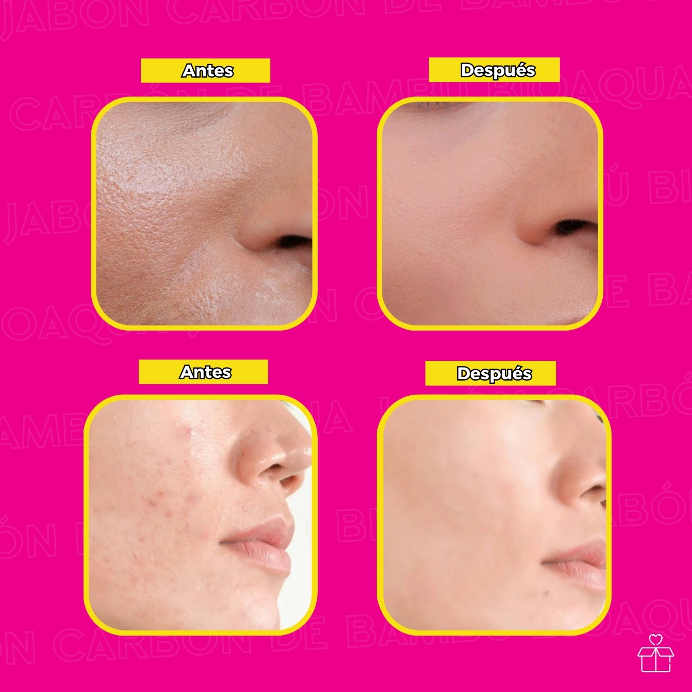 Jabón Carbon Bambo Exfoliante.