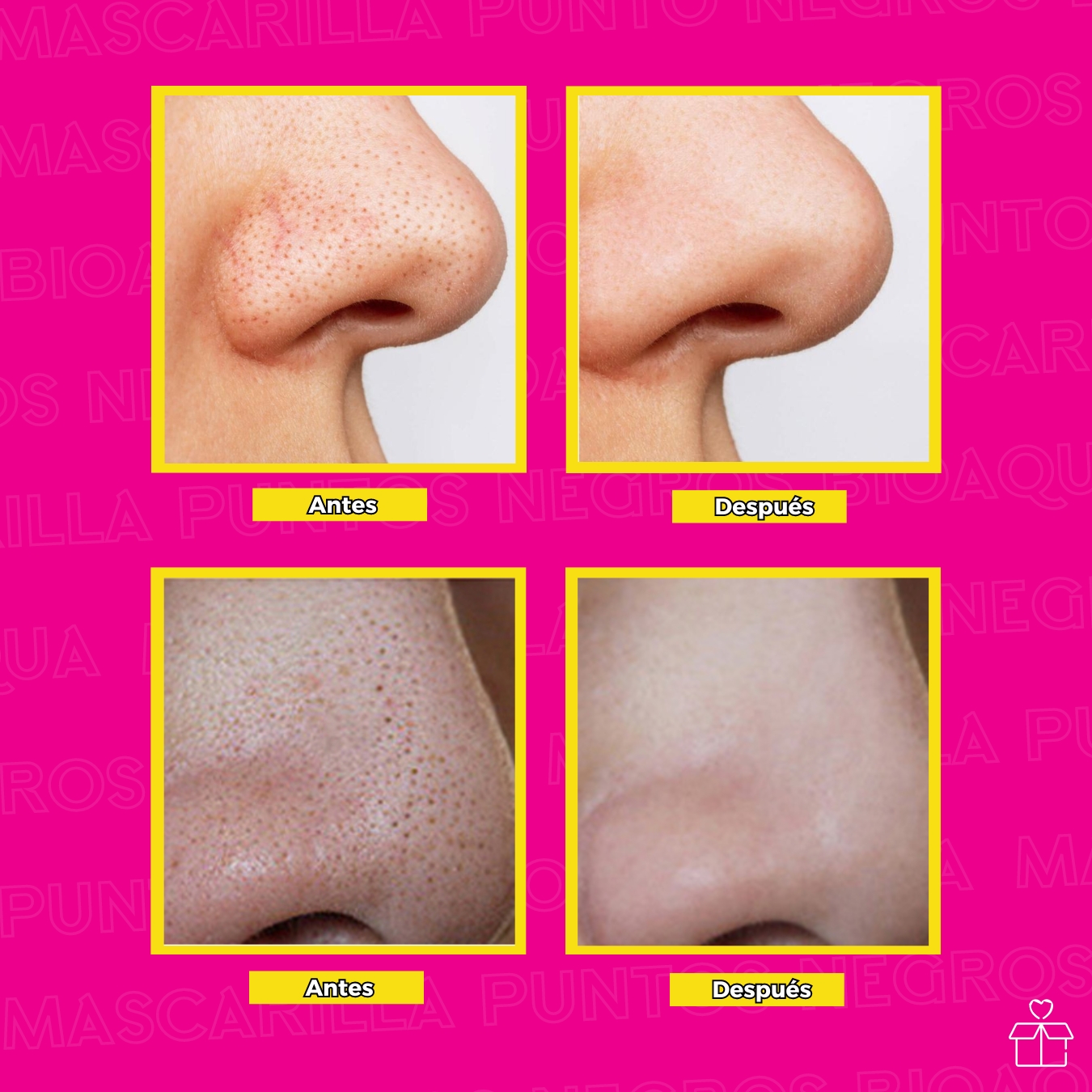 Mascarilla Para Puntos Negros Carbon Activado.