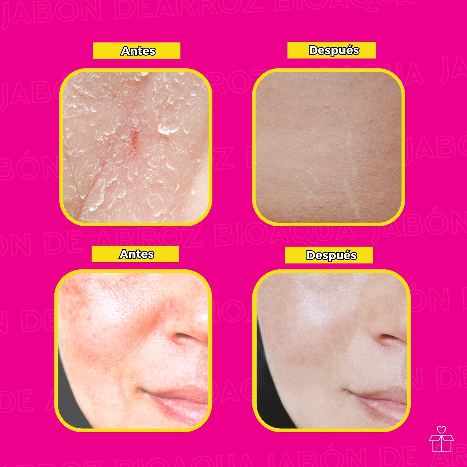 Jabón De Arroz Aclarante.